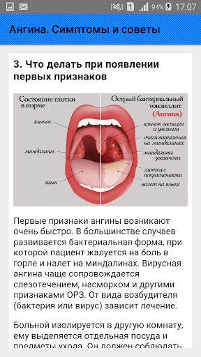 Ангина Симптомы Отличие Фото
